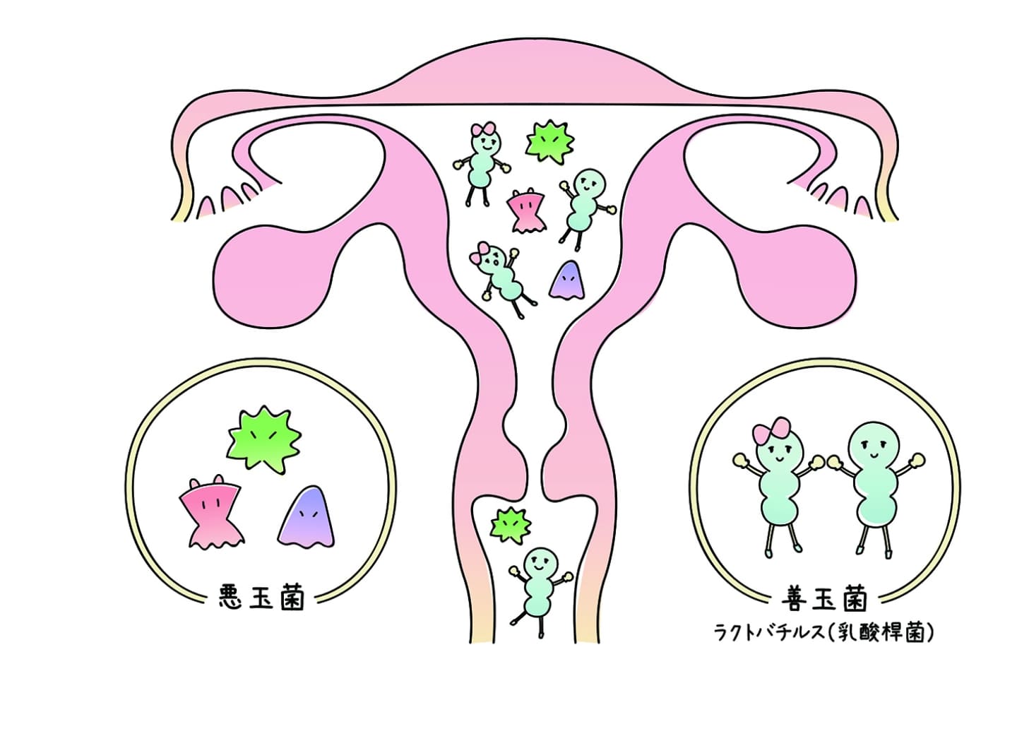 反復着床不全－子宮内フローラ検査 | 大川産婦人科・高砂分院